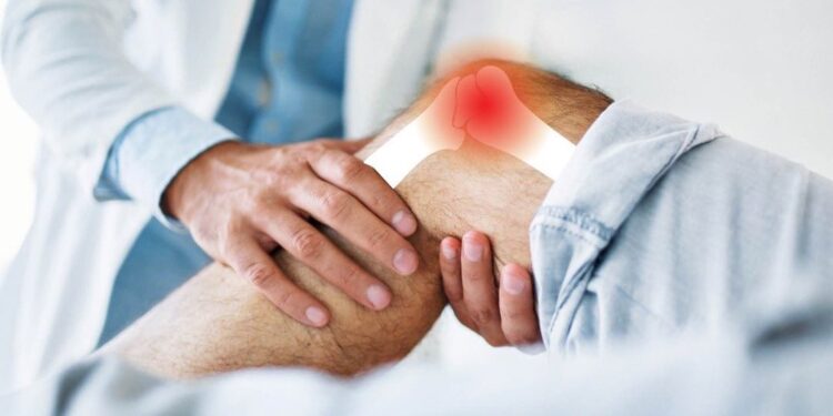 Innovación científica de UCB dentro de la reumatología en México