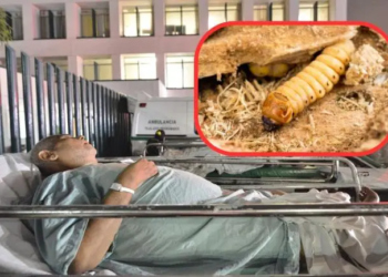 Suman cuatro casos de miasis por gusano barrenador en humanos en México