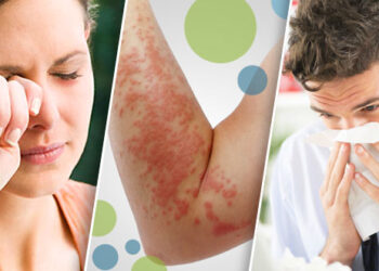 Día Mundial de la Alergia: Hasta un 40% de los mexicanos presentan algún tipo de alergia